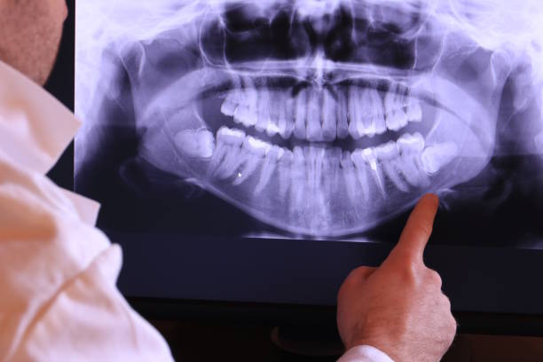 Best Broken Tooth Emergency  in Liberty Triangle, FL
