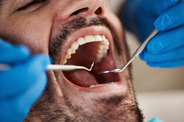 Best Dentist for Tooth Abscess  in Liberty Triangle, FL